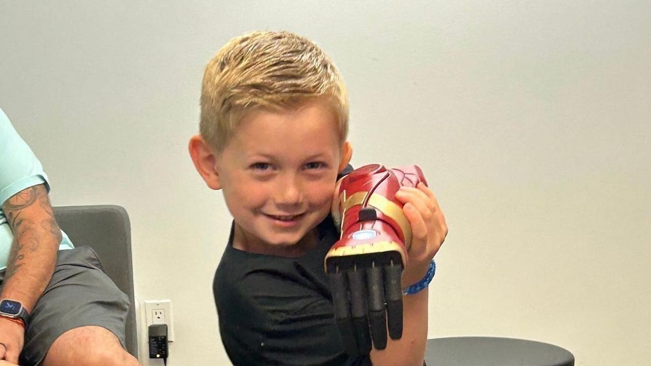 At Five US Boy with One Hand Gets Youngest Bionic Hero Arm