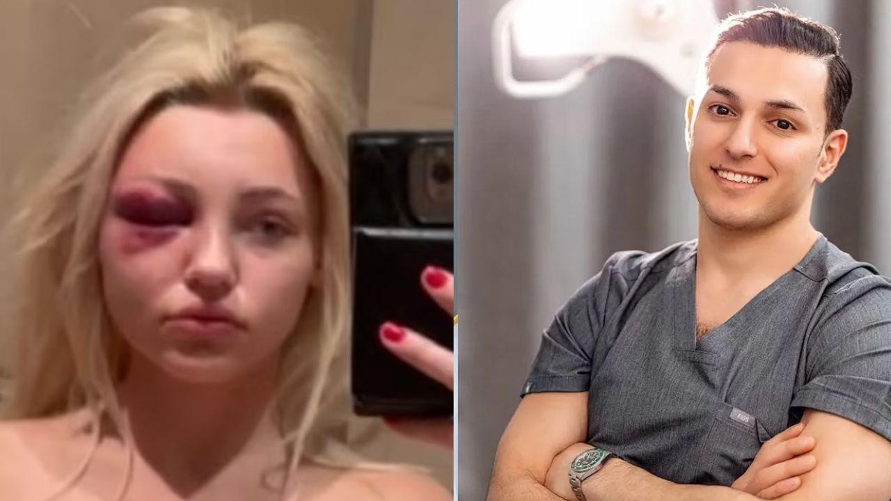 Model Accuses Plastic Surgeon Boyfriend of Abuse and Sex Trafficking