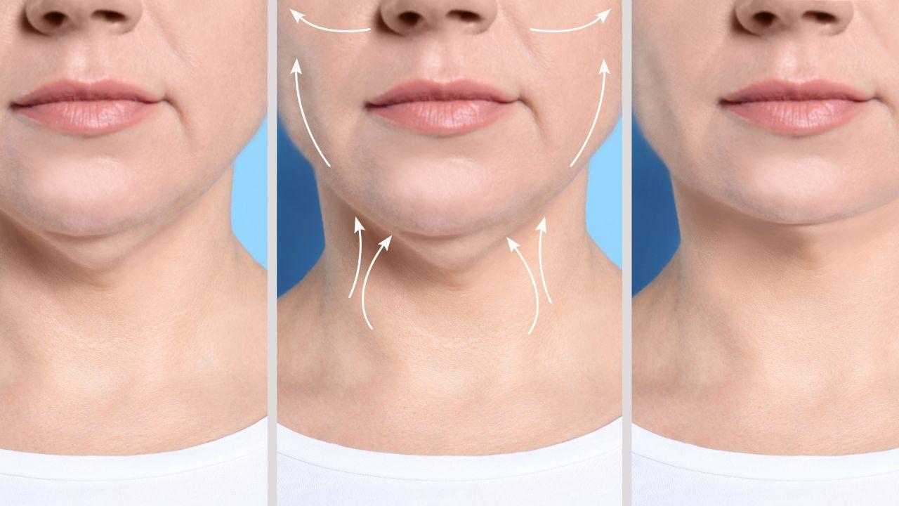 How to Reduce Double Chin Naturally at Home