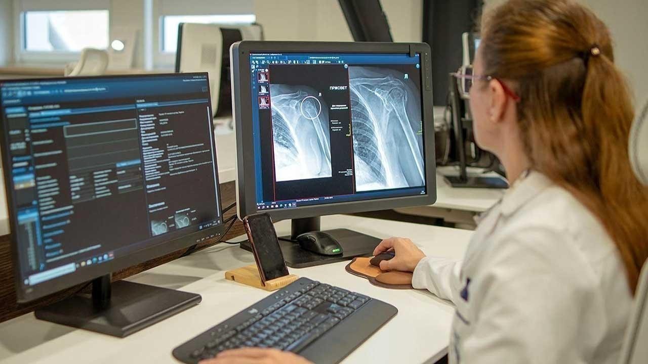 Moscow Launches AI Service for Diagnosing Shoulder Fractures