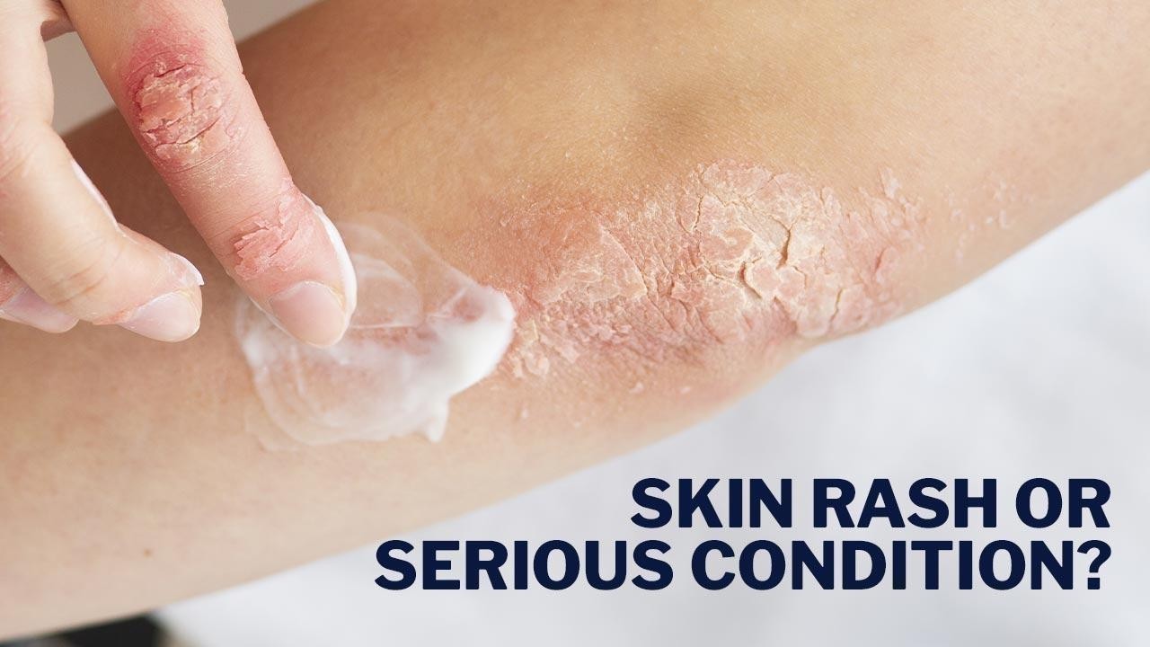 Skin Changes You Shouldn t Ignore  When a Rash Is More Than a Rash