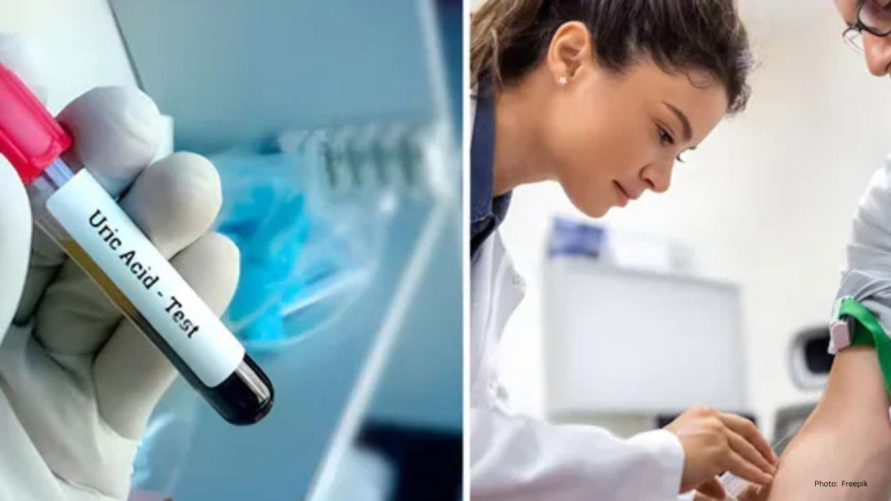 High Uric Acid? Know 5 Health Conditions That Could Be the Cause