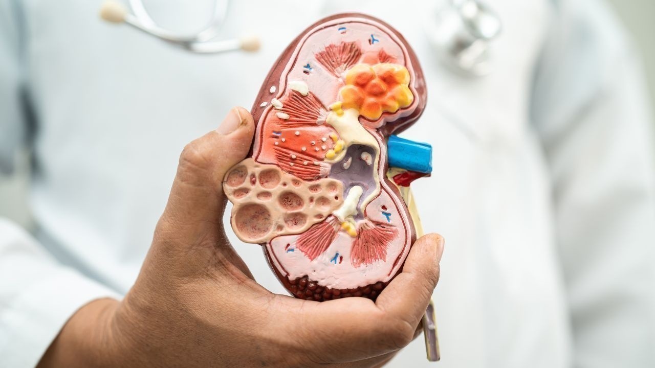 India Faces Rising Chronic Kidney Disease Cases in 2023