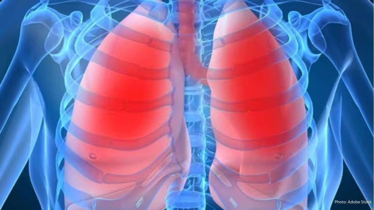 Doctor Warns Against Common COPD Myths as Risks Rise for Non-Smokers and Young People